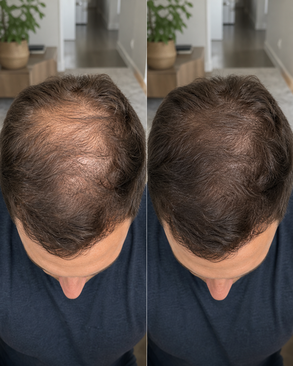Generated side-by-side crown thinning progression