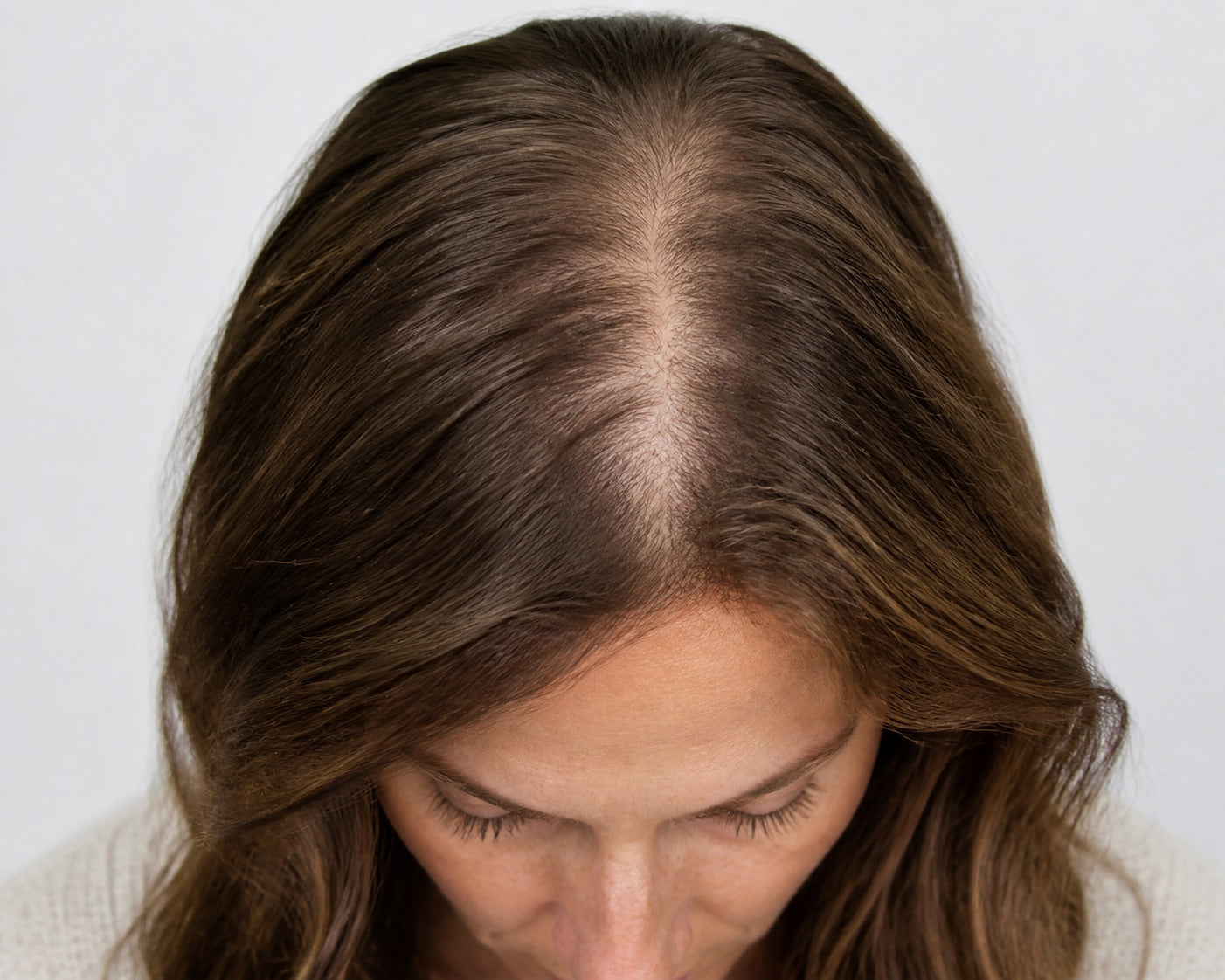 Widening center part with visible scalp